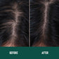 Regrowth X™ — Minoxidil Anti-Hair Loss Mousse