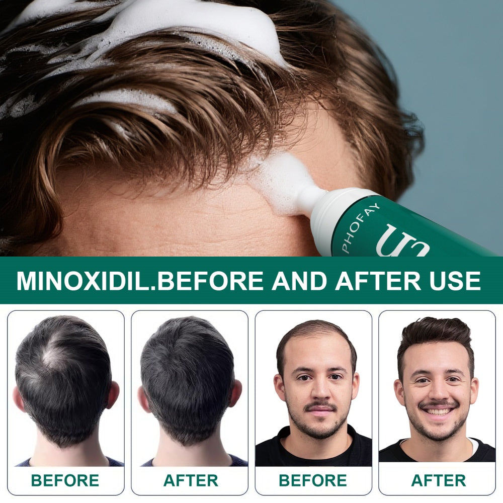 Regrowth X™ — Minoxidil Anti-Hair Loss Mousse